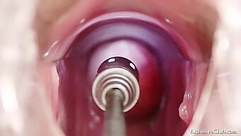 Amateur Babe Undergoes Bizarre Speculum Examination And Enema